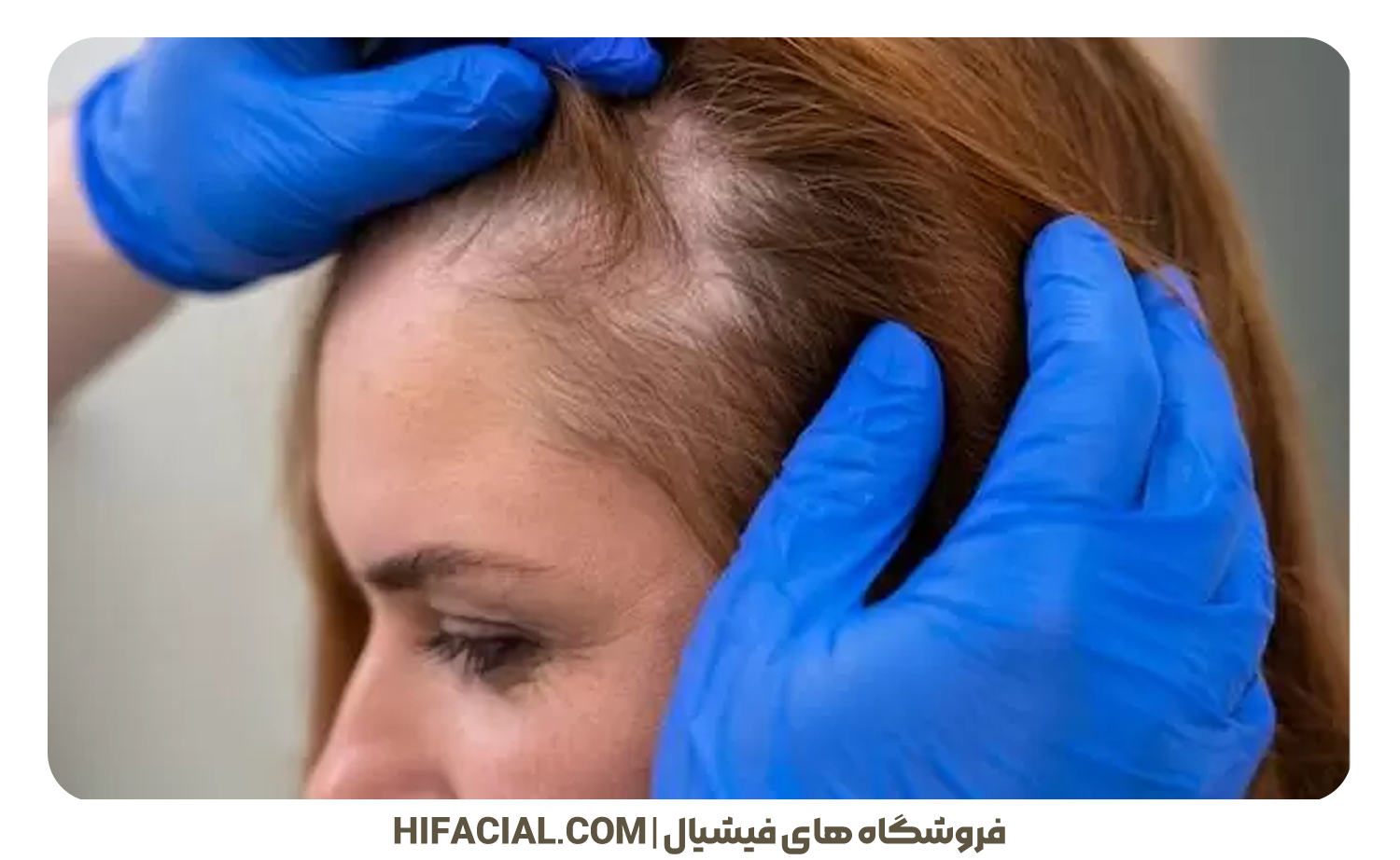 آموزش اسکالپ سر