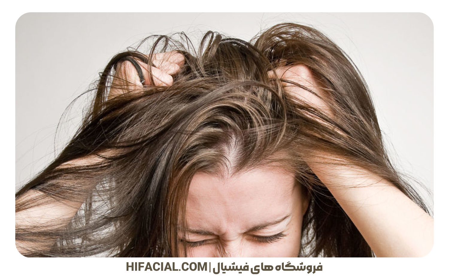 راههای پیشگیری از شوره سر