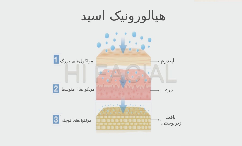 هیالورونیک